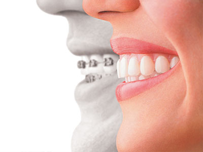 Alan S. Kuznick, DMD | Dental Bridges, CEREC and Implant Dentistry