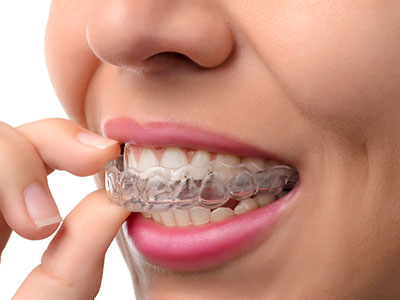 Alan S. Kuznick, DMD | Dental Fillings, Extractions and CBCT