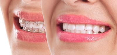 Alan S. Kuznick, DMD | Dental Cleanings, Sleep Apnea and Crowns