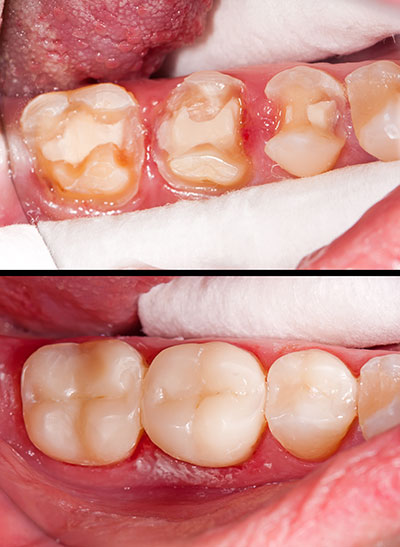 Alan S. Kuznick, DMD | Dental Bridges, Dentures and TMJ Disorders