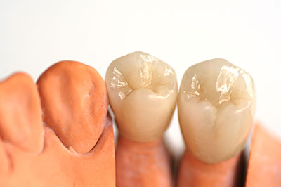 Alan S. Kuznick, DMD | Dental Bridges, Oral Exams and CBCT
