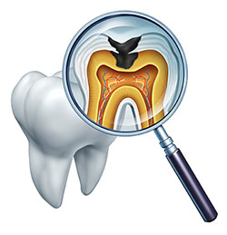 Alan S. Kuznick, DMD | Root Canals, Dental Fillings and Dentures