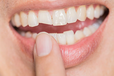 Alan S. Kuznick, DMD | CEREC, Root Canals and Pediatric Dentistry