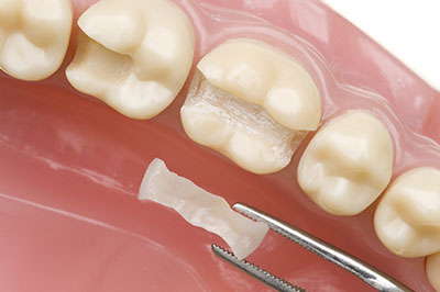 Alan S. Kuznick, DMD | Dental Fillings, CEREC and Dentures
