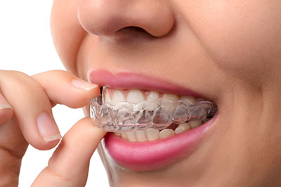 Alan S. Kuznick, DMD | Night Guards, Root Canals and Dental Fillings