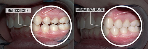 Alan S. Kuznick, DMD | Oral Exams, Preventative Program and Extractions