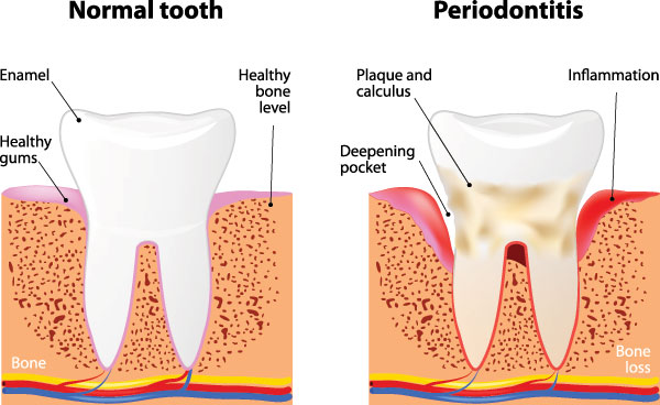 Alan S. Kuznick, DMD | Dental Fillings, Night Guards and Dentures