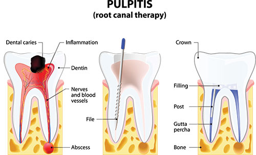 Alan S. Kuznick, DMD | Sleep Apnea, Crowns and CBCT
