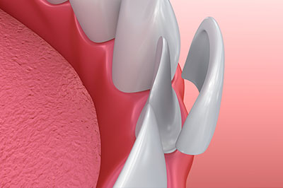 Alan S. Kuznick, DMD | Root Canals, Sleep Apnea and Oral Exams