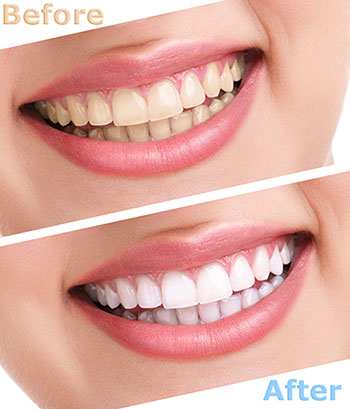 Alan S. Kuznick, DMD | Dental Fillings, Pediatric Dentistry and Extractions