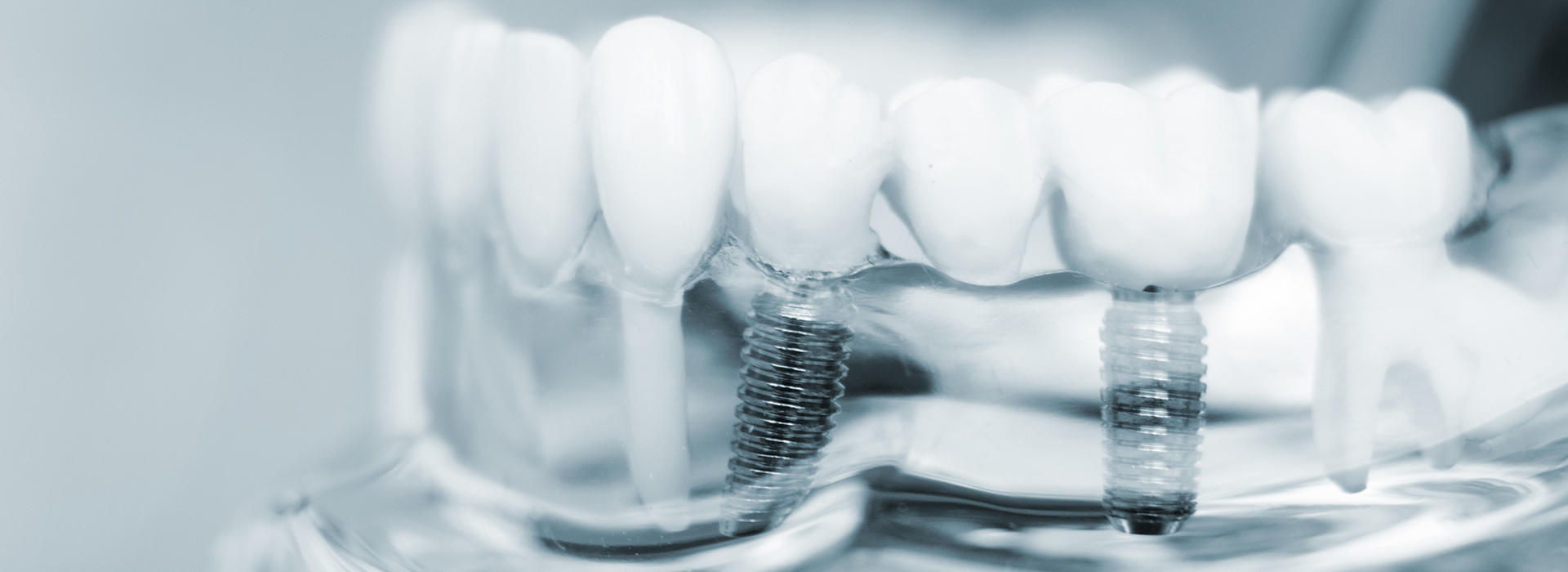 Alan S. Kuznick, DMD | Preventative Program, Sleep Apnea and Dental Bridges