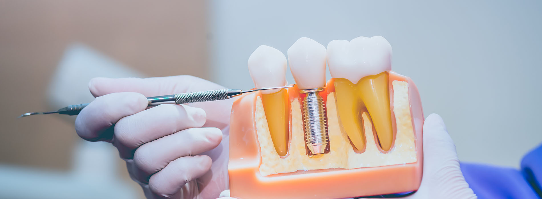 Alan S. Kuznick, DMD | Veneers, Implant Dentistry and Night Guards